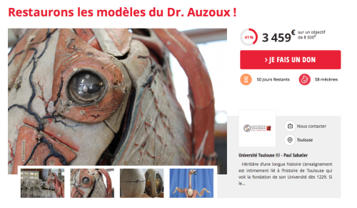 Crowdfunding-Projekt zur Restaurierung der Auzoux' Modelle