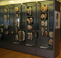Ausstellungsansicht, Foto: Moulagenmuseum Zürich