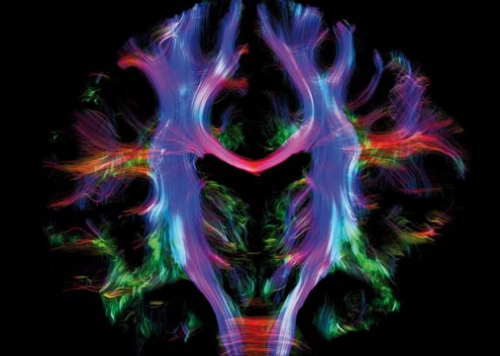 Faserverbindungen im menschlichen Gehirn, Foto: Alfred Anwander/Max-Planck-Institut für Kognitions- und Neurowissenschaften